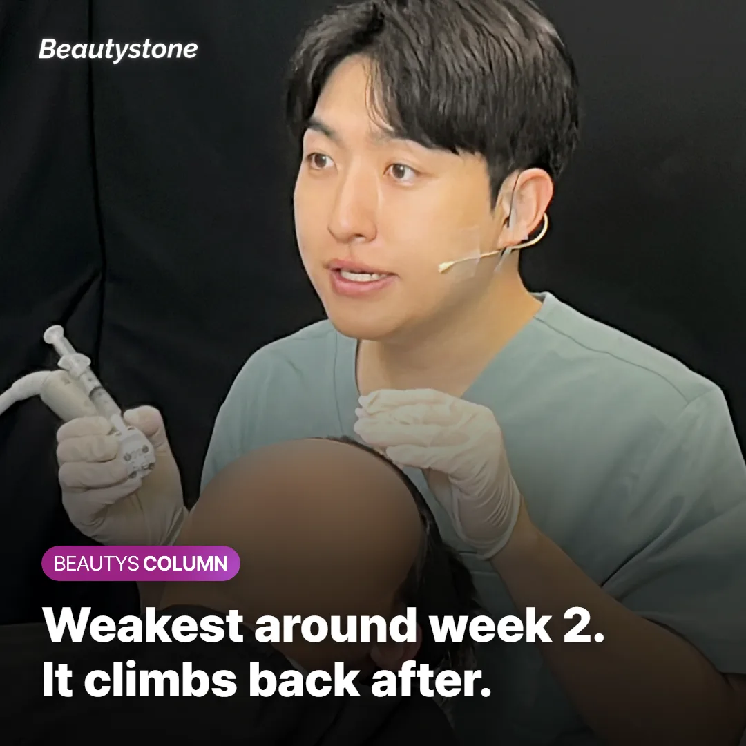 Bite force timeline after masseter Botox, weakest near week two