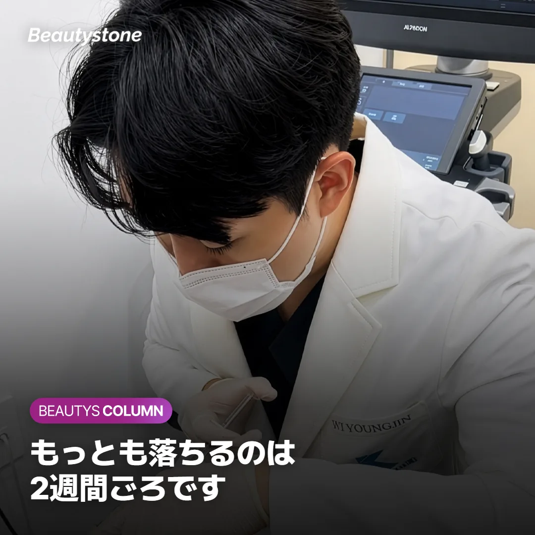 エラボトックス後に噛む力がもっとも落ちやすい時期を示すイメージ