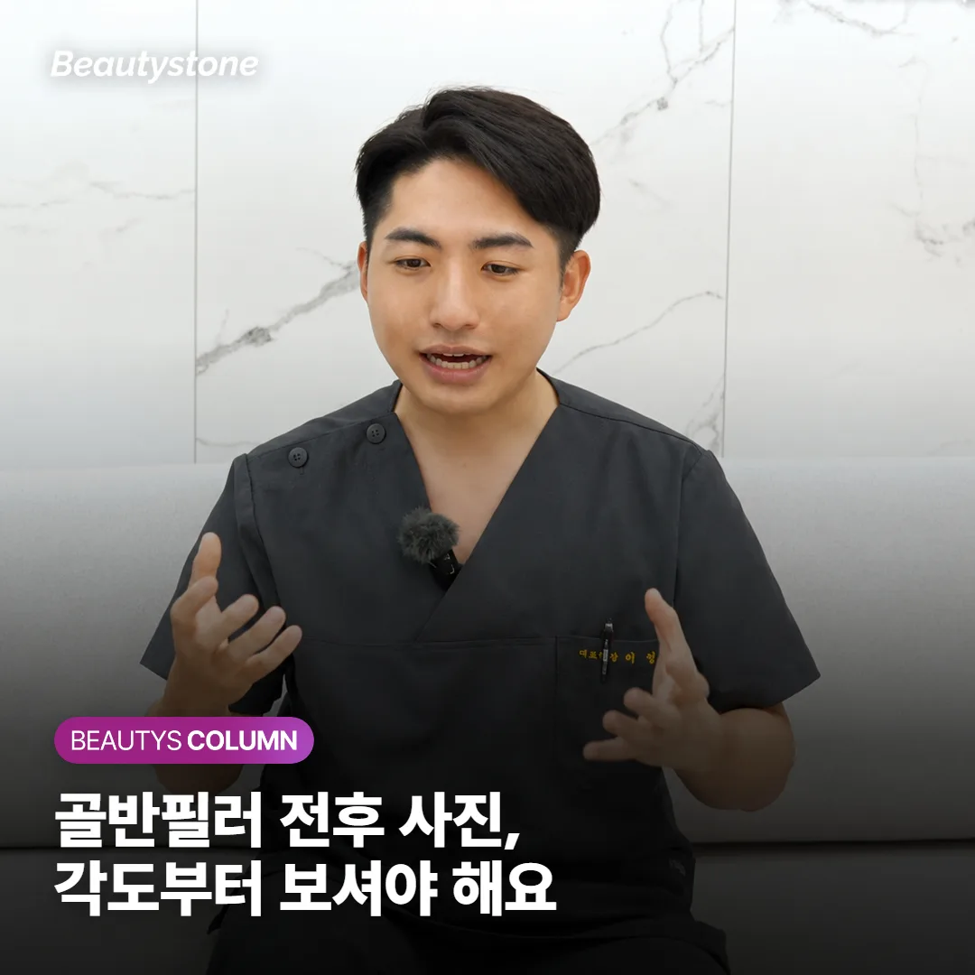 골반필러 전후 사진, 정면보다 사선·앉은 자세를 보셔야 해요