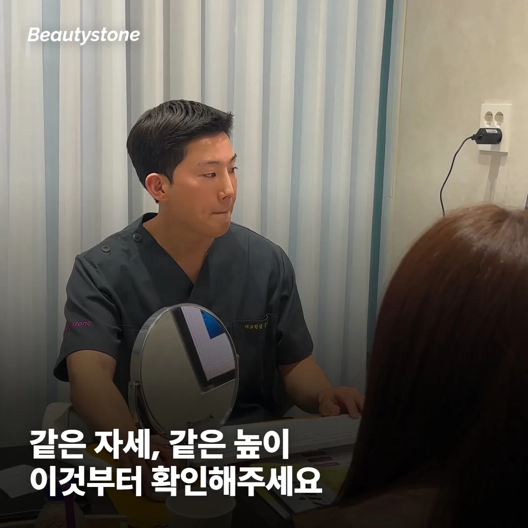전후 사진에서 가장 먼저 봐야 할 건 촬영 조건이에요