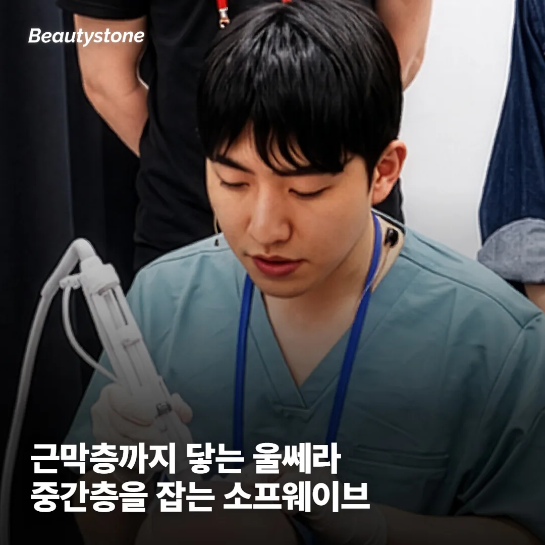 차이는 