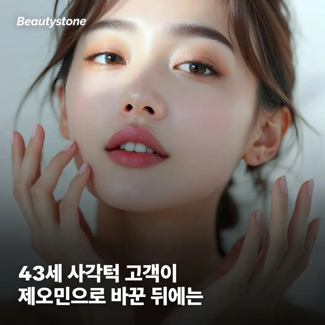 제오민 후기에서 반복해서 나오는 전환 케이스