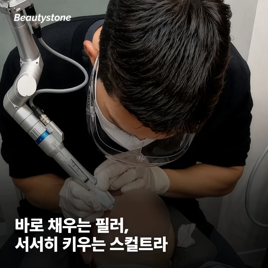 바로 채우는 쪽과 서서히 키우는 쪽은 무엇이 다를까요