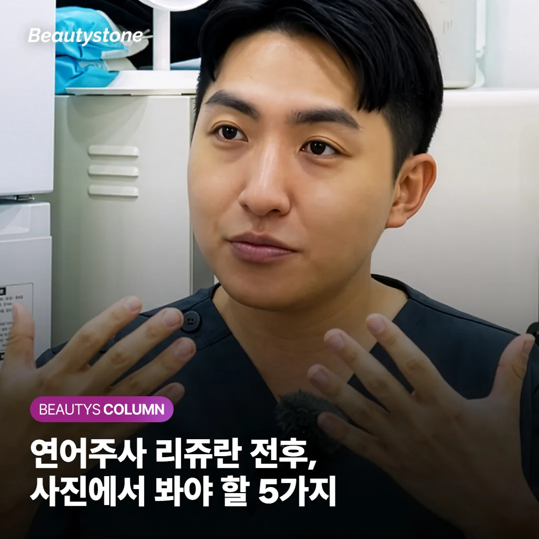 연어주사 리쥬란 전후, 사진에서 진짜 봐야 할 5가지