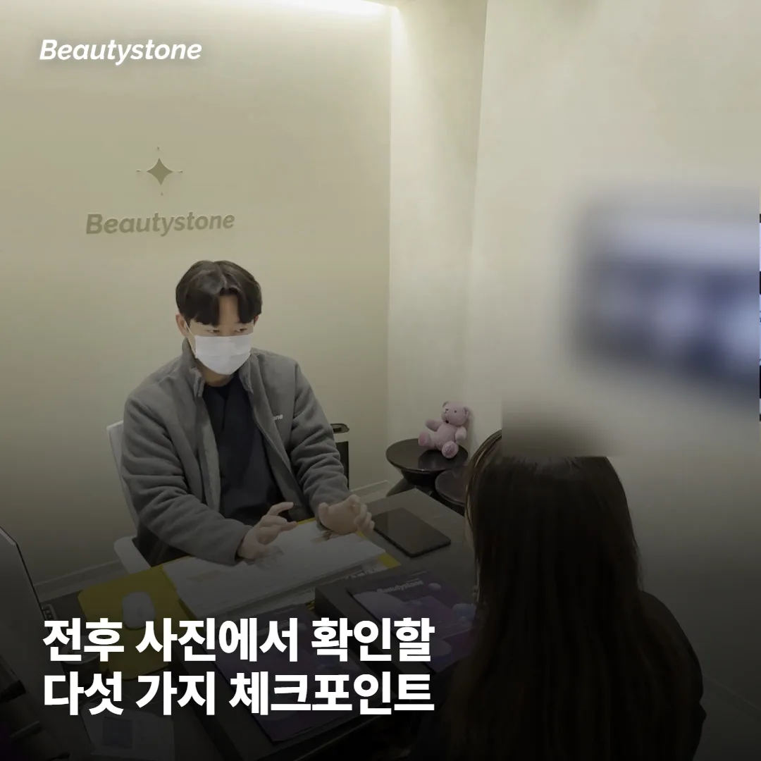 전후 사진 볼 때 체크할 5가지는 무엇인가요?