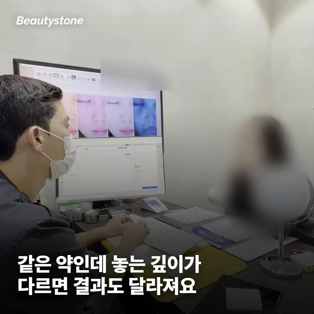스킨보톡스와 일반 보톡스, 같은 약인데 왜 결과가 다를까요