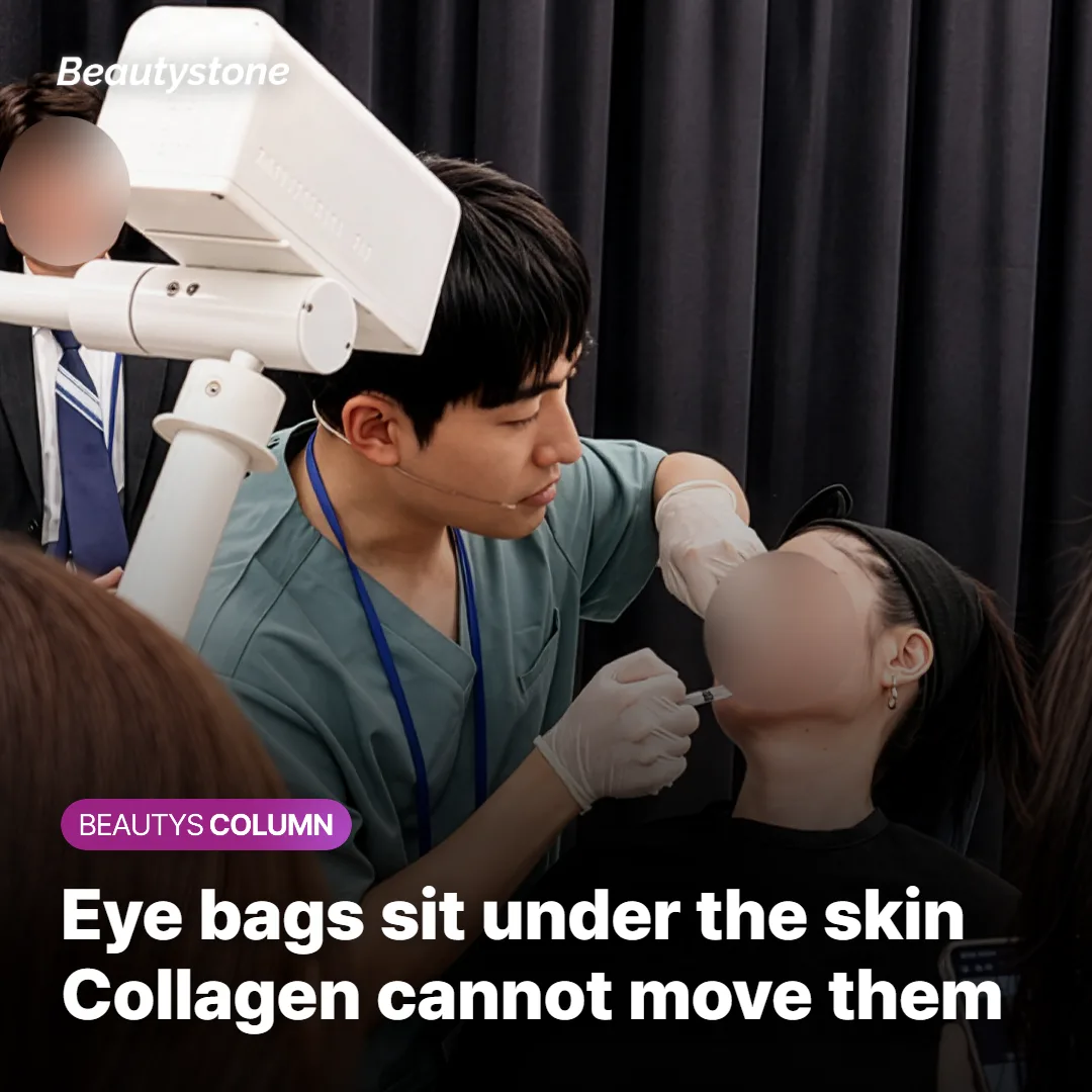 Why a bulging under-eye pouch sits below the layer a collagen booster reaches