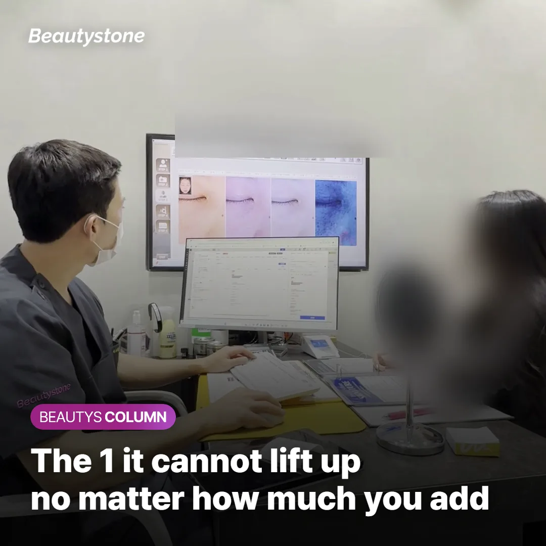 Why adding more volume does not raise tissue that has already descended along the jawline