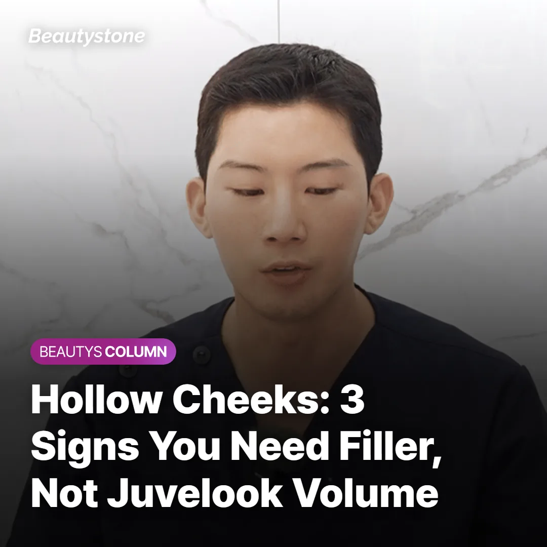 Hollow Cheeks: 3 Signs You Need Filler, Not Juvelook Volume