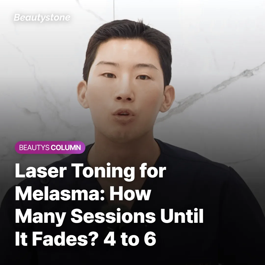 Laser Toning for Melasma: How Many Sessions Until It Fades? 4 to 6