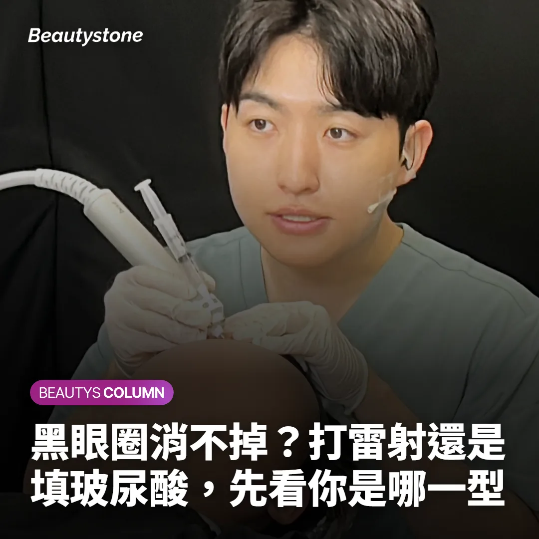 黑眼圈消不掉？打雷射還是填玻尿酸，先看你是哪一型
