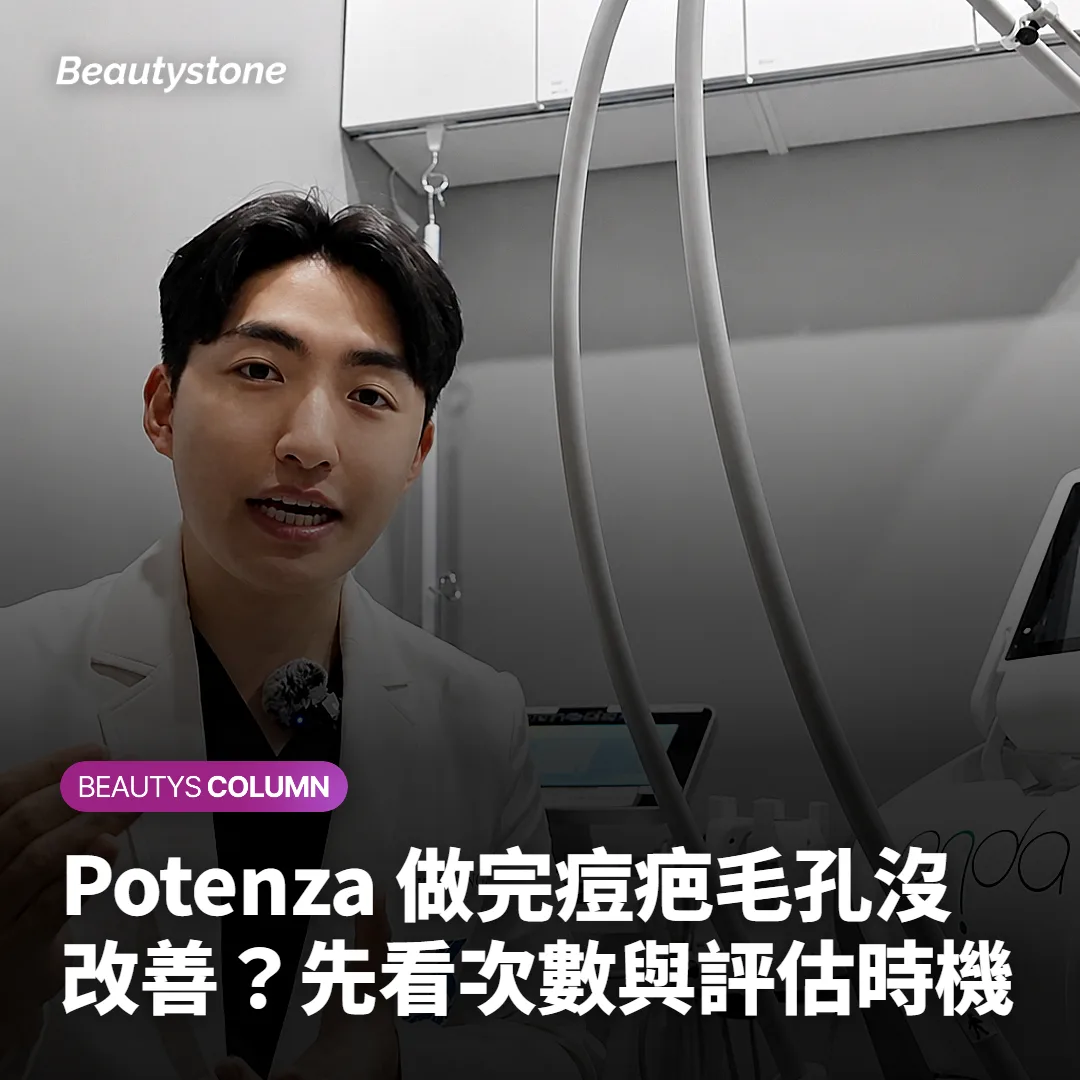 Potenza 做完痘疤毛孔沒改善？先看次數與評估時機