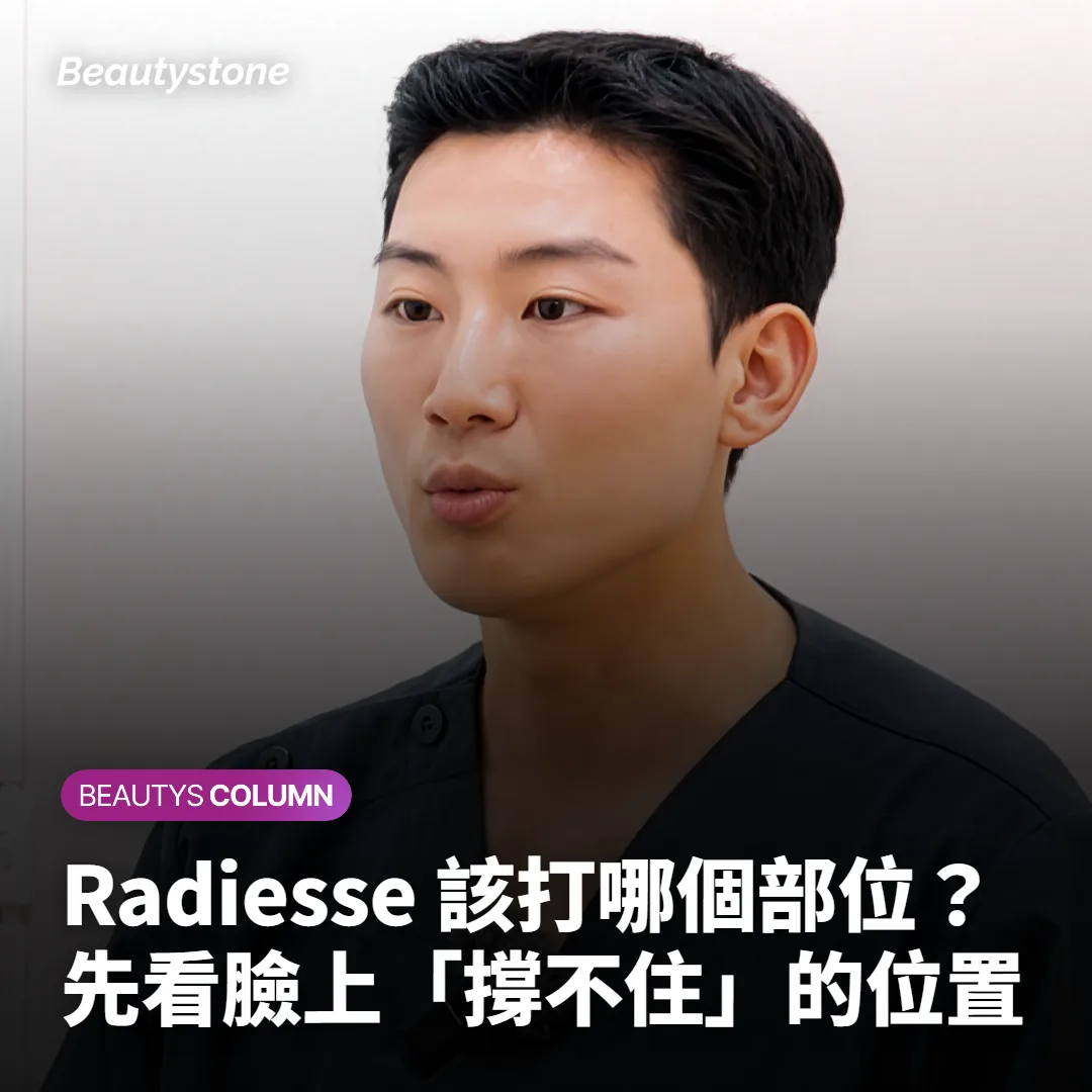 Radiesse 該打哪個部位？先看臉上「撐不住」的位置