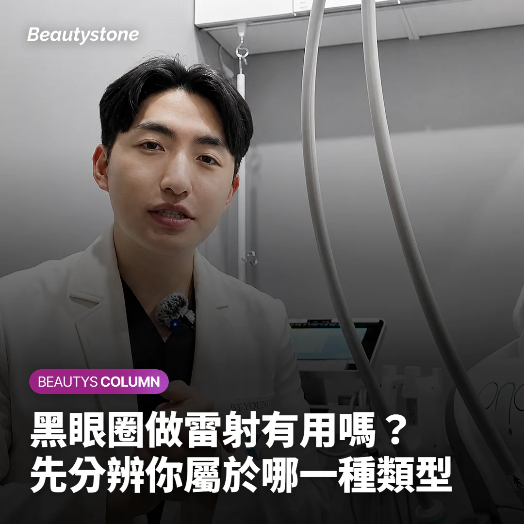 黑眼圈做雷射有用嗎？先分辨你屬於哪一種類型