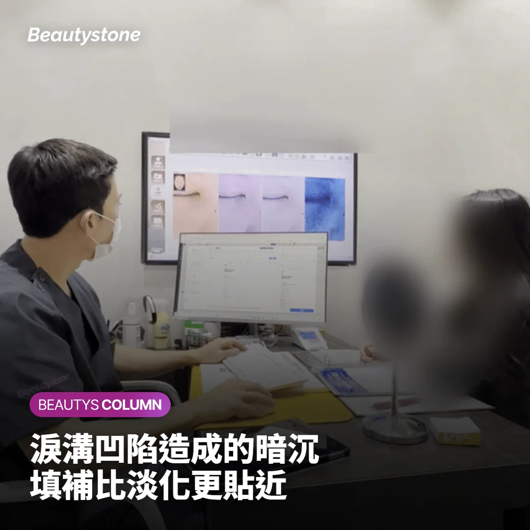 淚溝凹陷造成的黑眼圈，玻尿酸能維持多久？