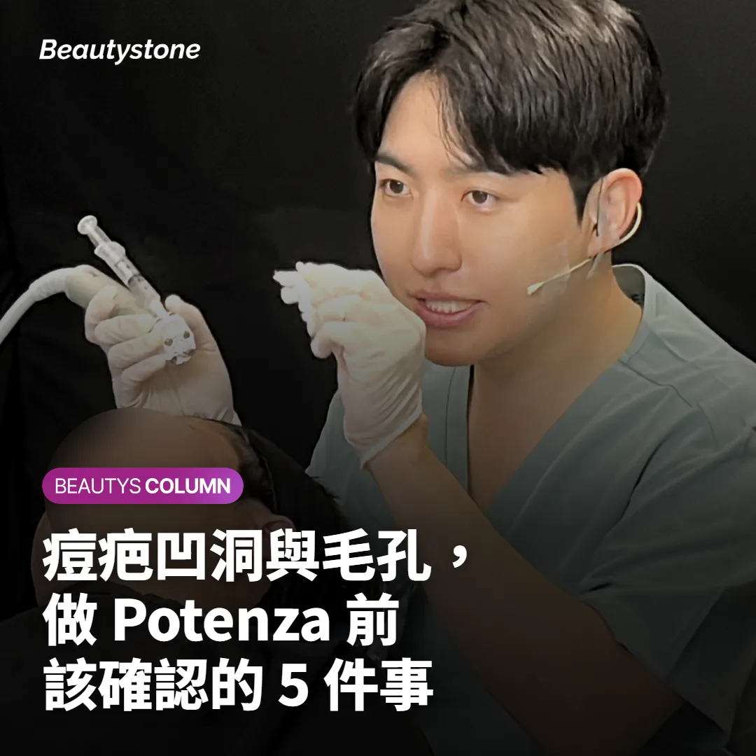 痘疤凹洞與毛孔，做 Potenza 前該確認的 5 件事