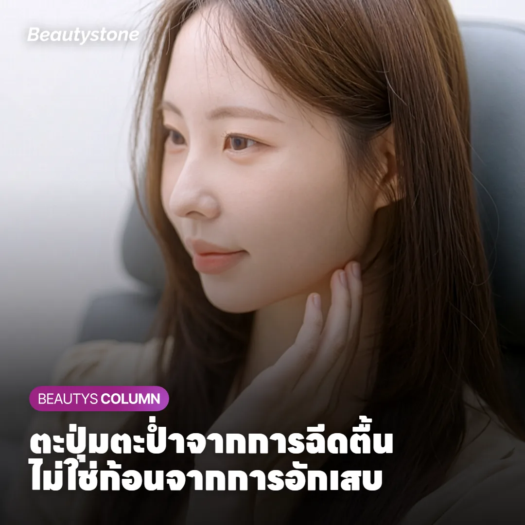 ผิวตะปุ่มตะป่ำหลังฉีด ใช่ก้อนอักเสบอย่างที่กลัวหรือเปล่า