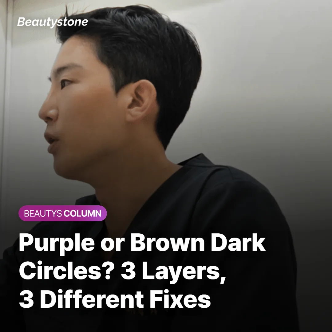 Purple or Brown Dark Circles? 3 Layers, 3 Different Fixes