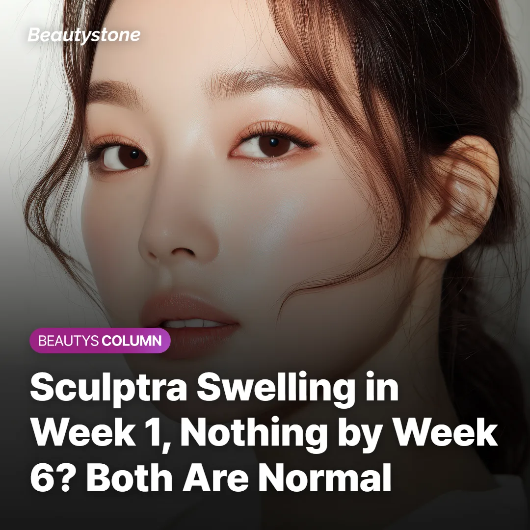 Sculptra Swelling in Week 1, Nothing by Week 6? Both Are Normal