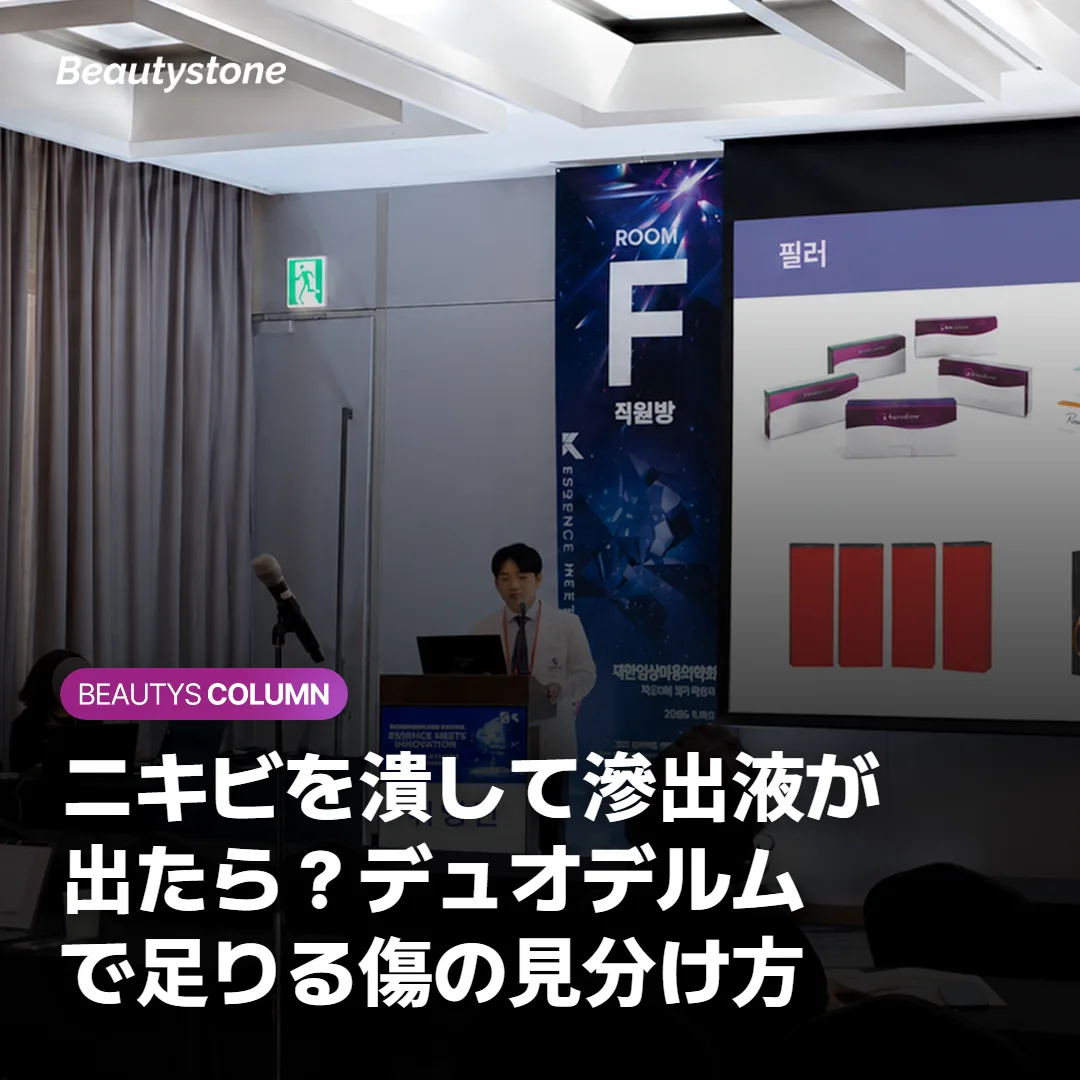 ニキビを潰して滲出液が出たら？デュオデルムで足りる傷の見分け方