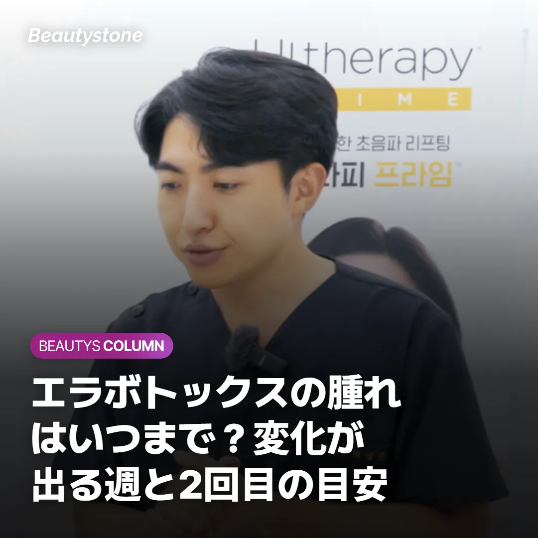 エラボトックスの腫れはいつまで？変化が出る週と2回目の目安