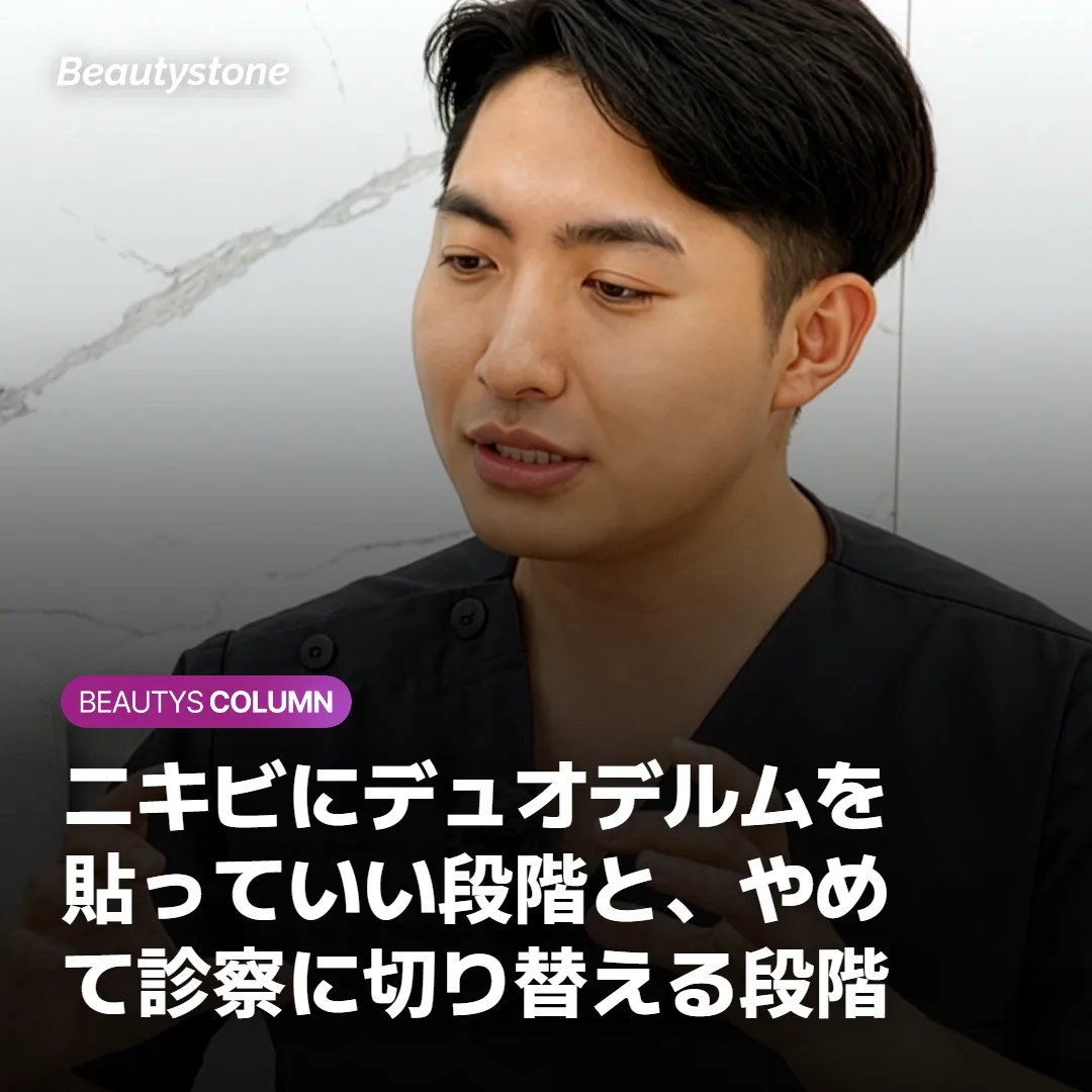 ニキビにデュオデルムを貼っていい段階と、やめて診察に切り替える段階