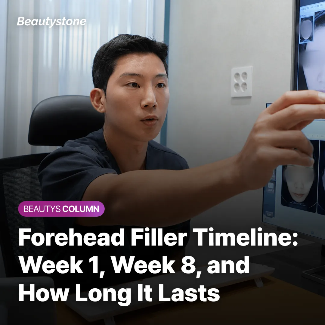 Forehead Filler Timeline: Week 1, Week 8, and How Long It Lasts
