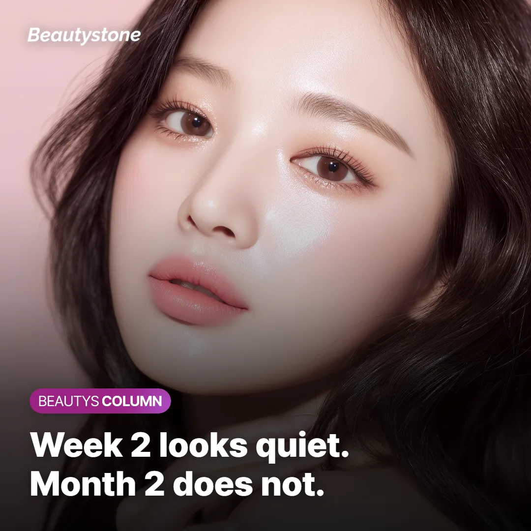 Volume building gradually after Sculptra