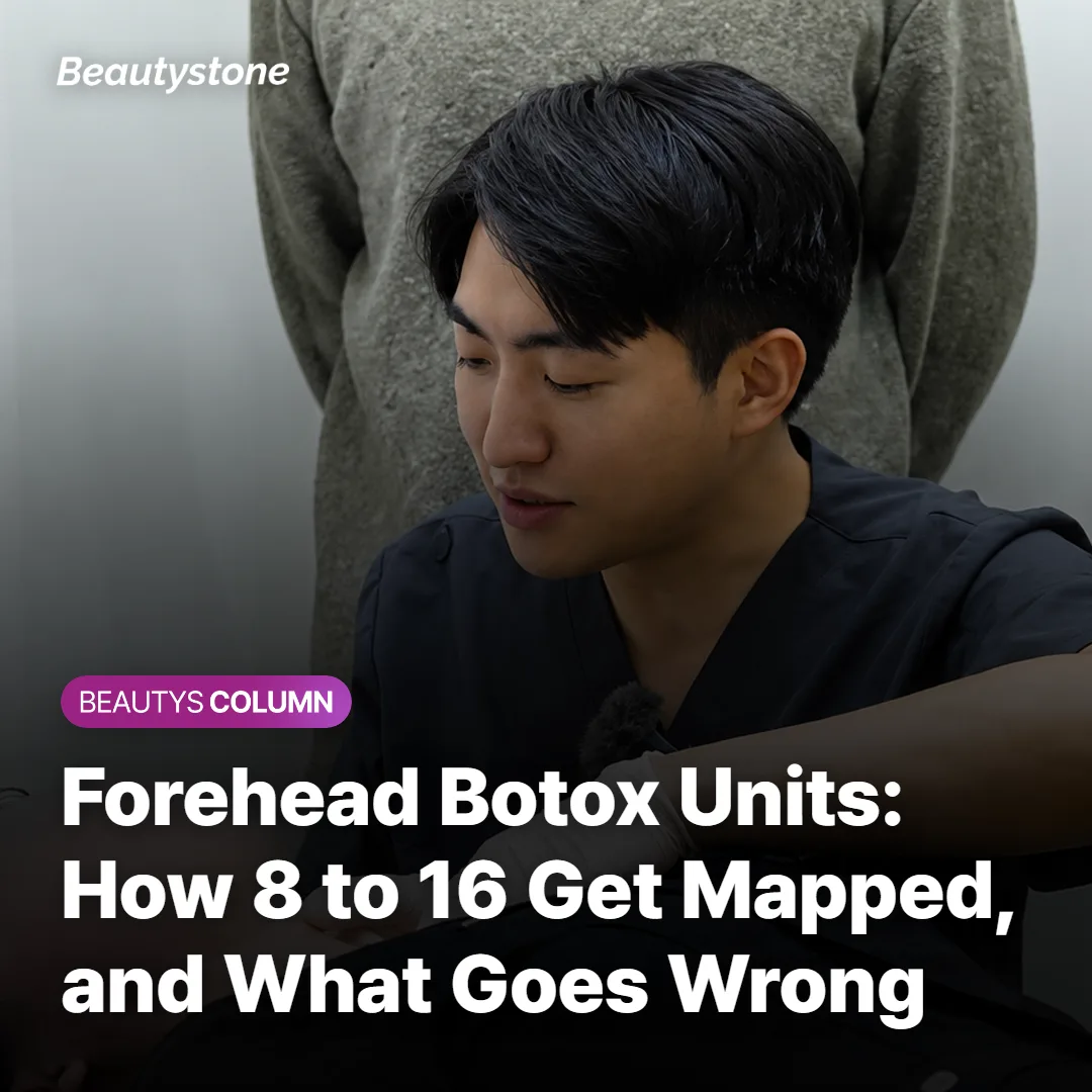 Forehead Botox Units: How 8 to 16 Get Mapped, and What Goes Wrong