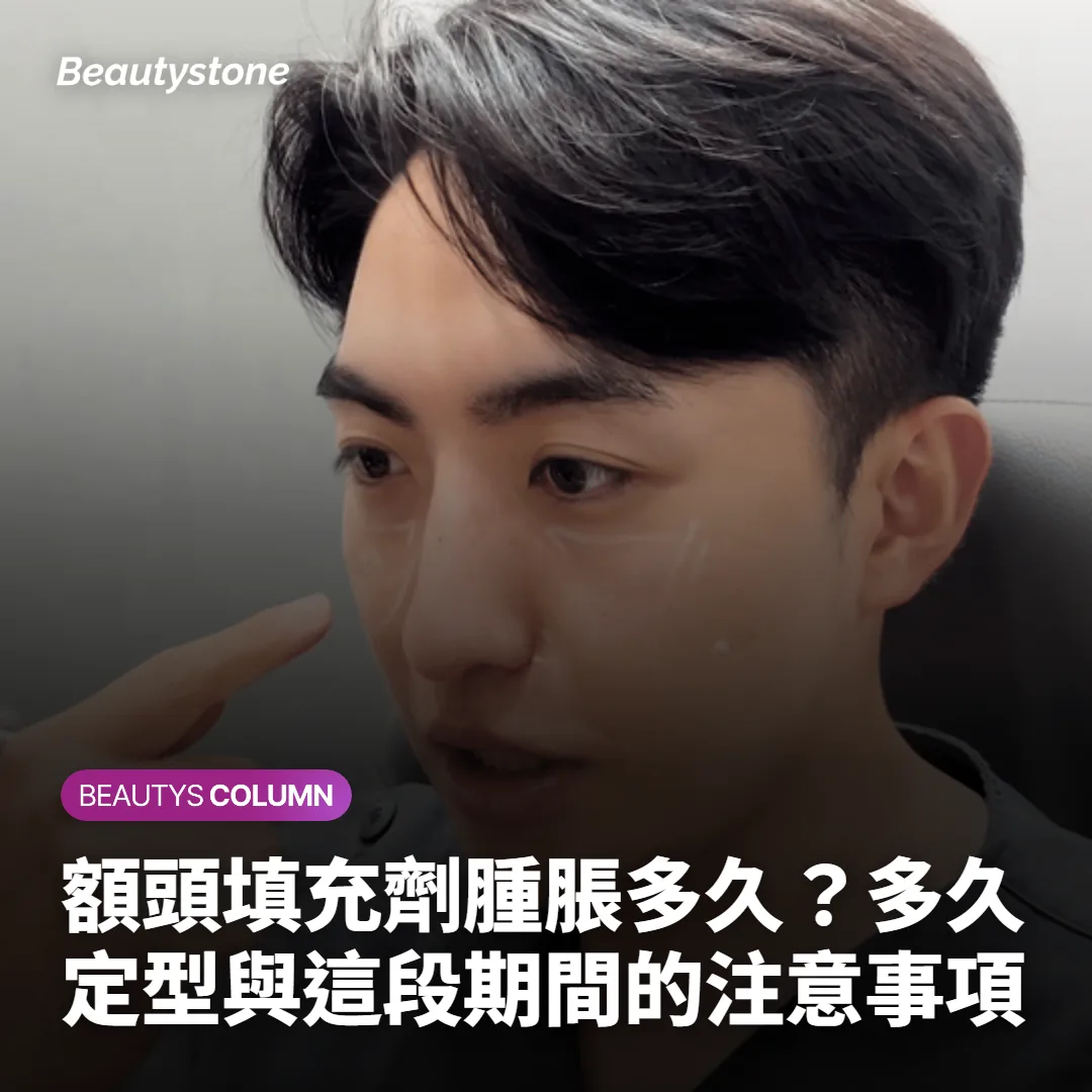額頭填充劑腫脹多久？多久定型與這段期間的注意事項