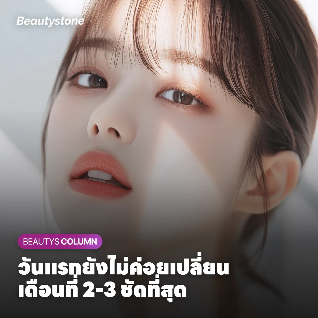 ภาพแสดงแนวโน้มการรับรู้ผลลัพธ์แต่ละช่วงตั้งแต่วันที่ทำถึง 6 เดือน