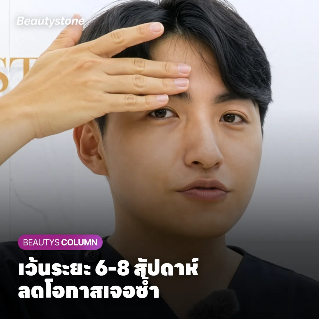 ภาพแสดงระยะห่างการทำ Sculptra แต่ละครั้ง