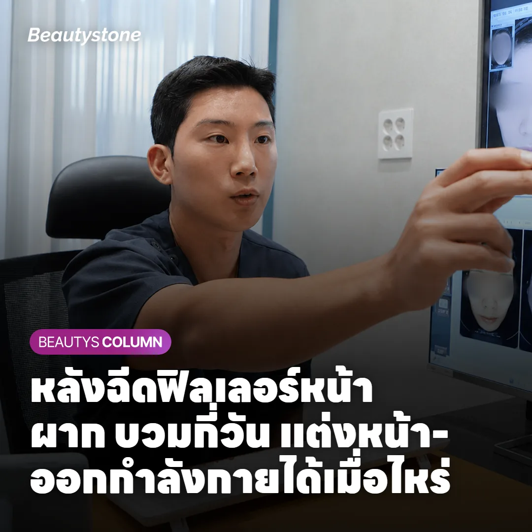 ภาพแสดงการฉีดฟิลเลอร์ HA เติมปริมาตรหน้าผาก
