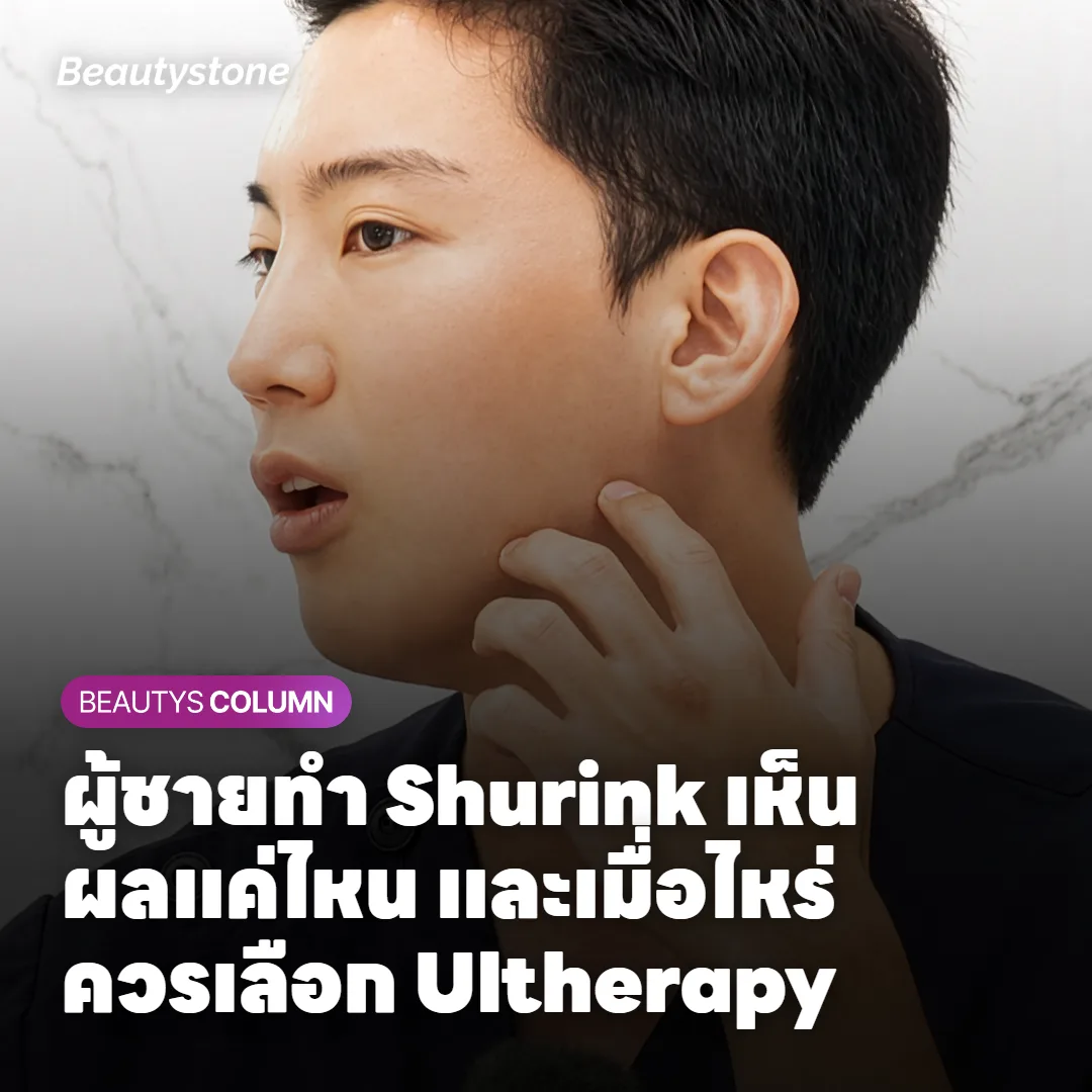 ภาพแสดงกลไกของ HIFU ที่ส่งความร้อนกระตุ้นชั้นผิวหนังแท้และชั้น SMAS