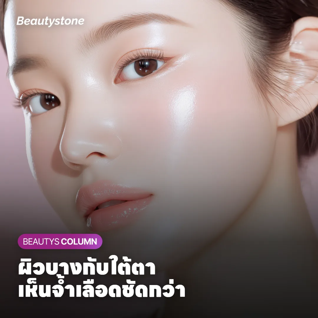 ภาพแสดงจ้ำเลือดเปลี่ยนสีและจางลงในราวสิบวัน