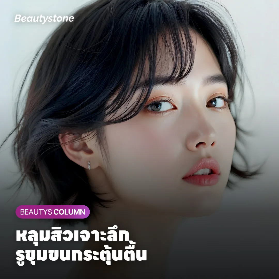 ภาพแสดงการเลือกความลึก หลุมสิวเจาะลึกและรูขุมขนกระตุ้นตื้น