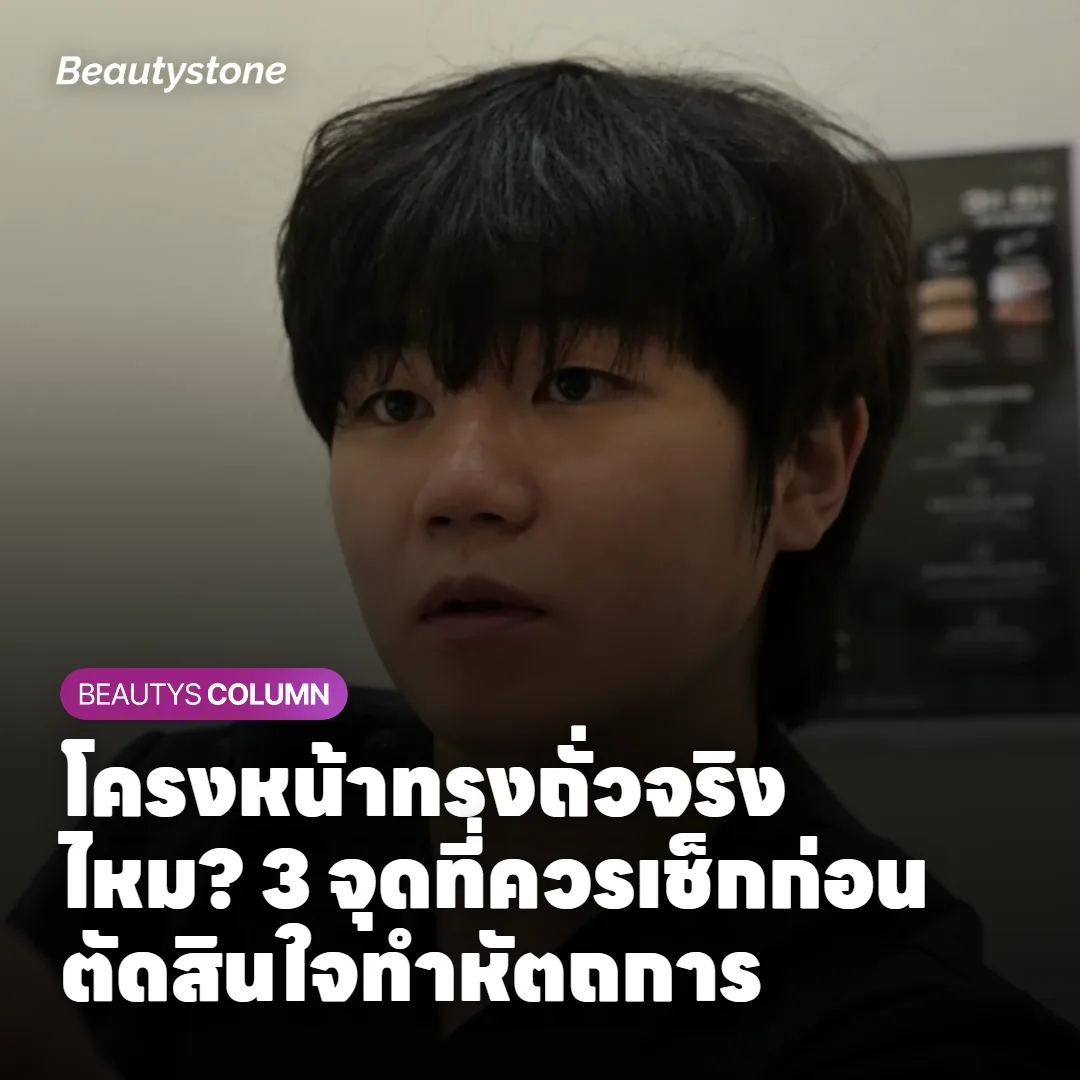 ภาพแสดงจุดที่ทำให้กระดูกแก้มดูเด่นในโครงหน้าทรงถั่ว