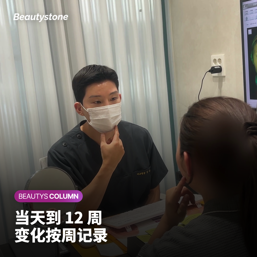 按周看:从当天到 12 周,脸上会发生什么