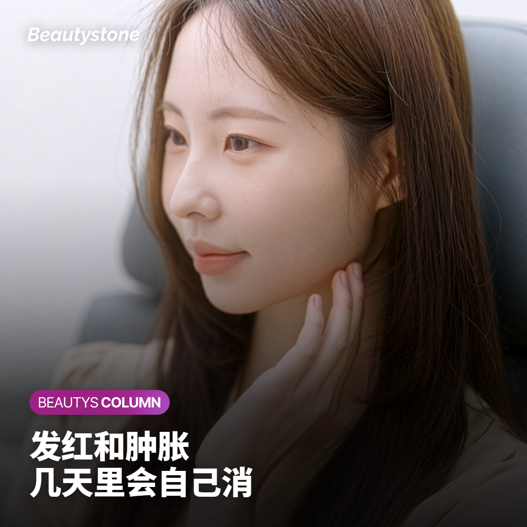 InMode FX 做完之后，诊室里最常见的三种反应