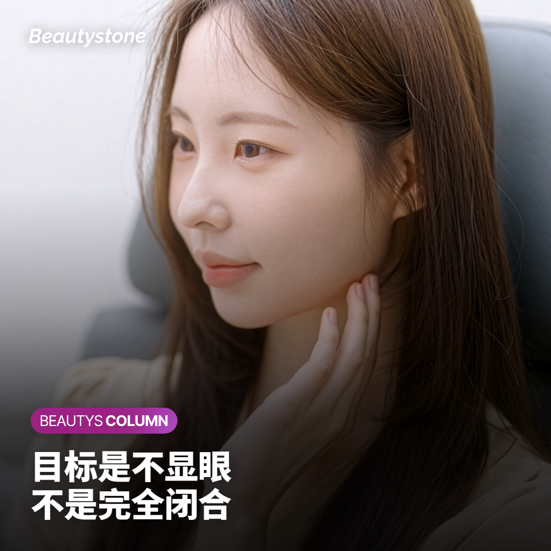 恢复与注意事项：把目标定在“不那么显眼”