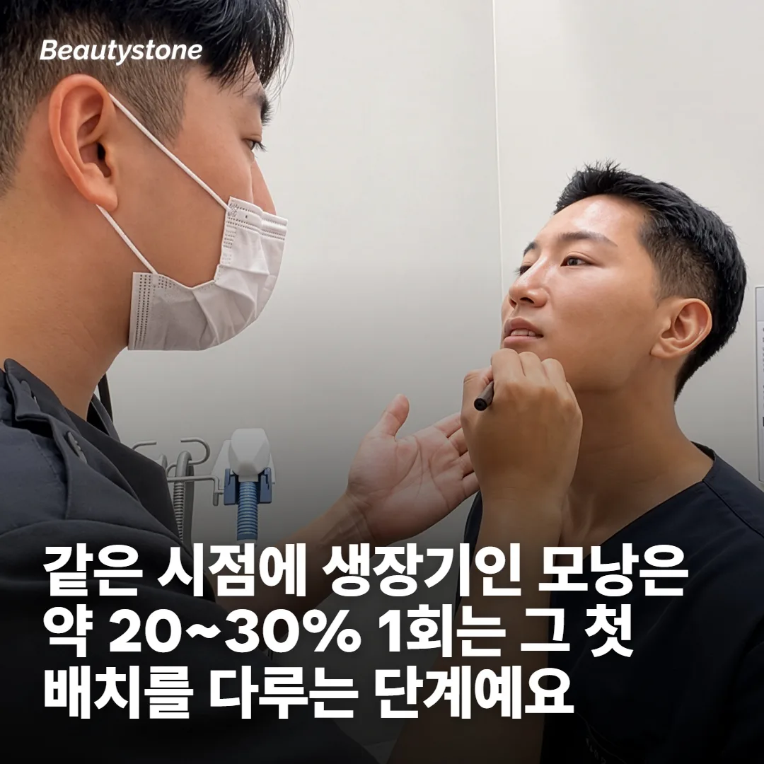 레이저 제모 1회가 실제로 하는 일