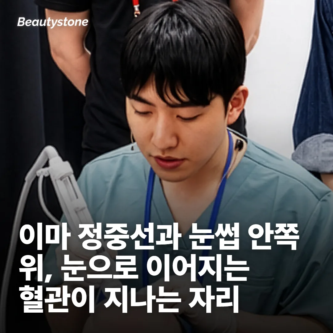 이마에서 피해야 하는 길이 있습니다