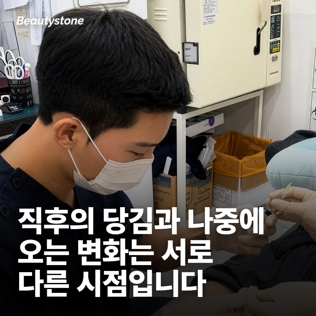 효과가 보이는 시점은 두 번 나뉘어 옵니다
