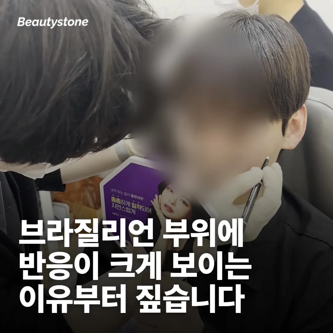 브라질리언 뒤에 올라오는 반응, 전부 부작용은 아닙니다