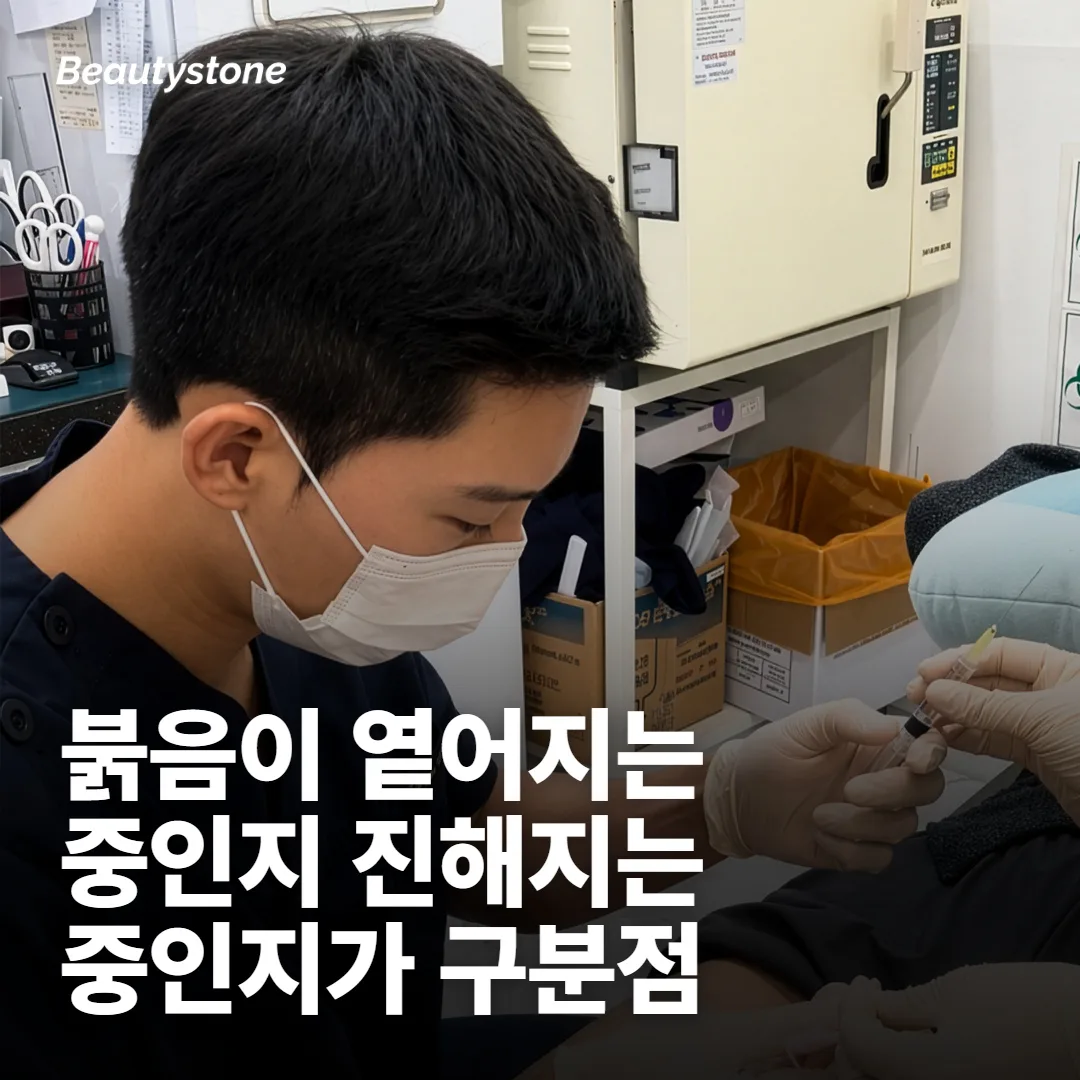 이런 상태면 날짜를 미루는 편이 낫습니다