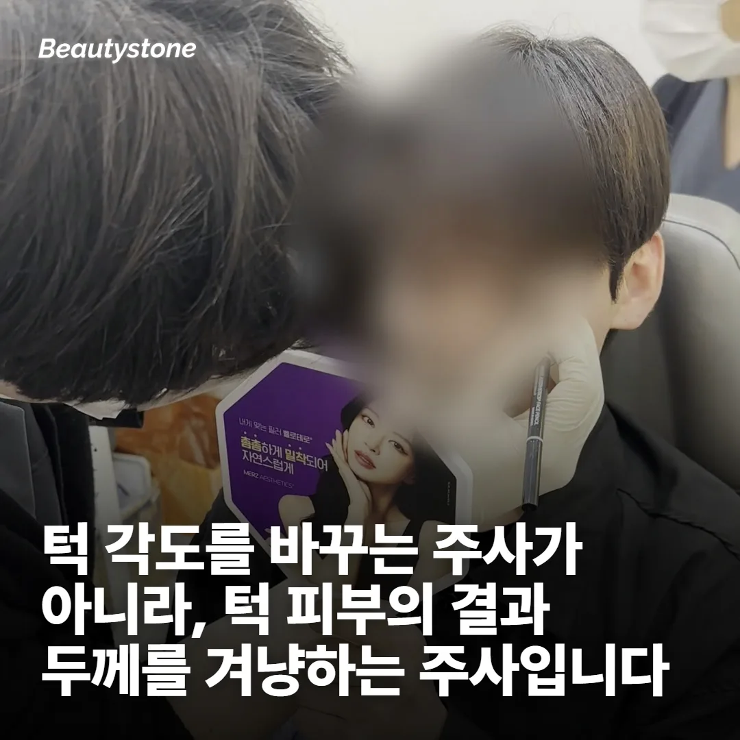 턱에 놓는 리쥬란이 실제로 닿는 자리