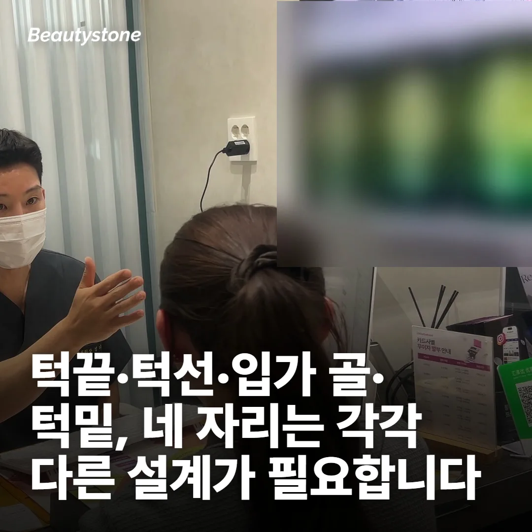 같은 턱이라도 네 군데가 각각 다릅니다