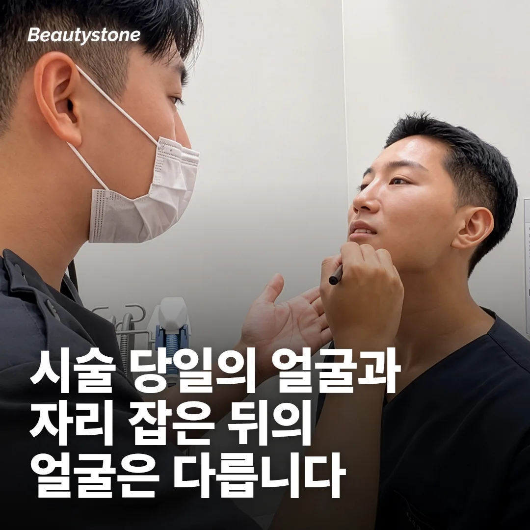 효과가 보이는 시점이 두 번으로 나뉩니다
