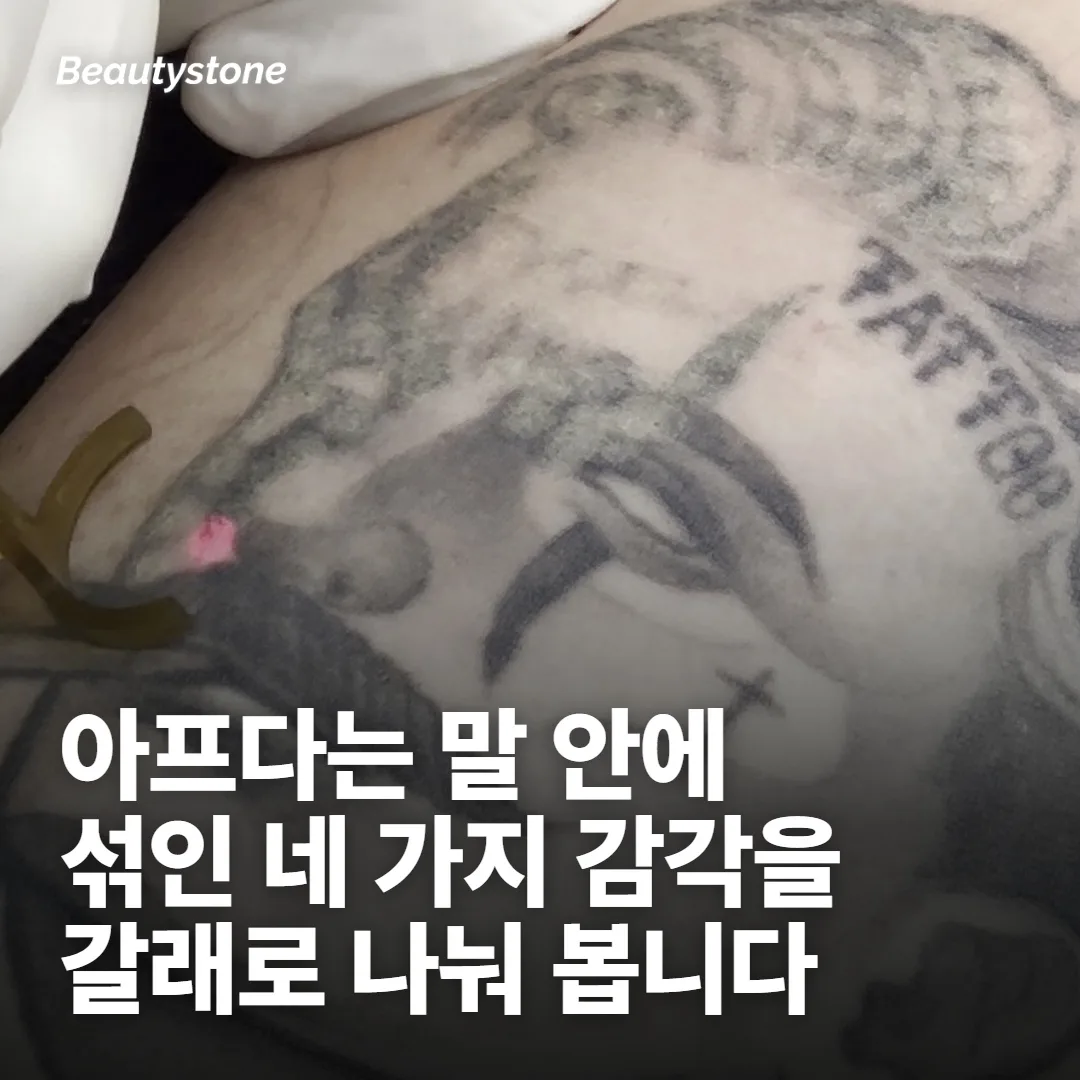 보톡스가 아픈 순간은 한 덩어리가 아니에요