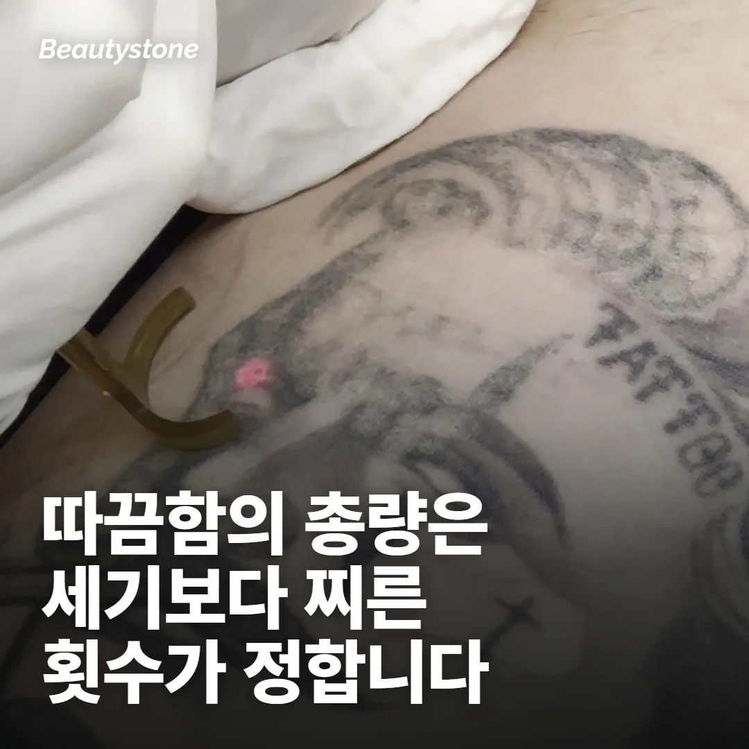 첫 번째 갈래: 바늘이 지나갈 때의 따끔함